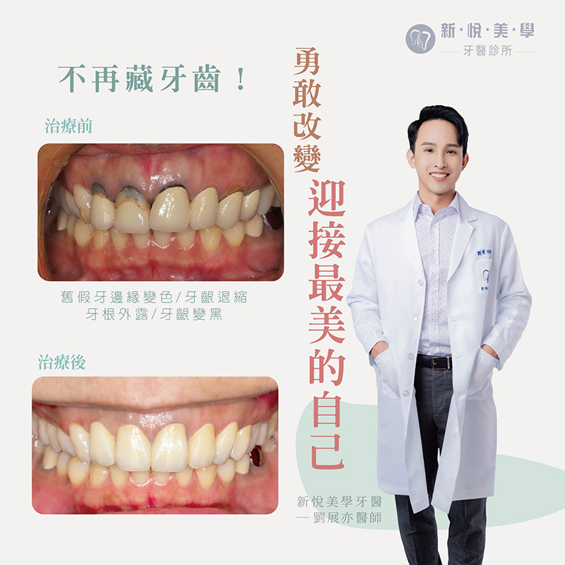 新悅美學牙醫診所的案例分享圖片